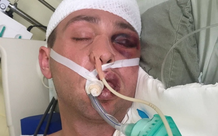 Zbiórka Wózek elektryczny dla Marcina - zdjęcie główne