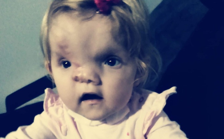 Zbiórka Na leczenie i rehabilitacje Juli - zdjęcie główne