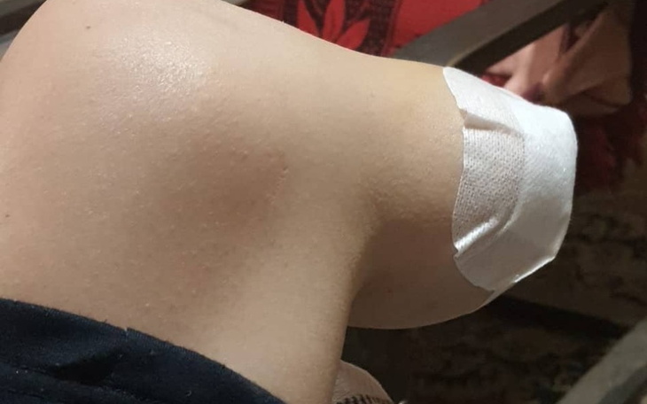 Zbiórka na Rehabilitacje i protezę - zdjęcie główne