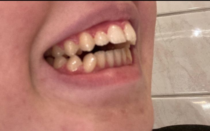 Zbiórka Założenie aparatu i leczenie - zdjęcie główne