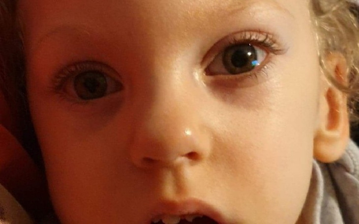 Zbiórka Zbieramy Dla Martynki - zdjęcie główne