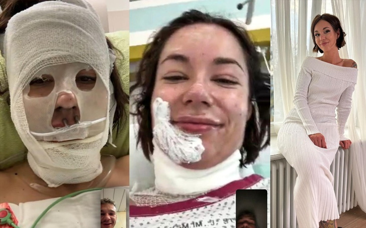 Kobieta po zabiegu, z uśmiechem i w dobrym nastroju.