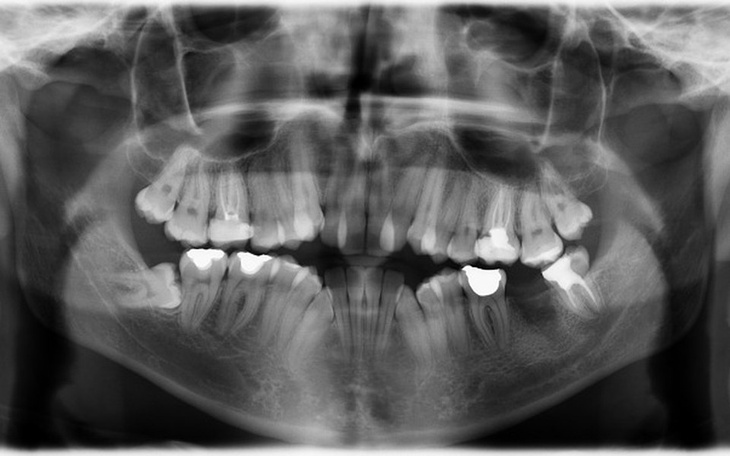 Zbiórka Leczenie dentystyczne do aparatu - zdjęcie główne