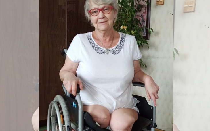 Zbiórka Protezy dla pani Ireny Gębskiej - zdjęcie główne