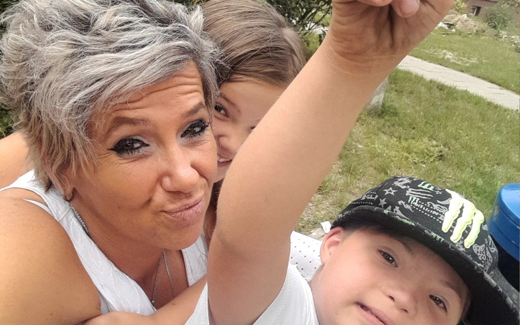 Zbiórka Martwica kosci pomocy - zdjęcie główne