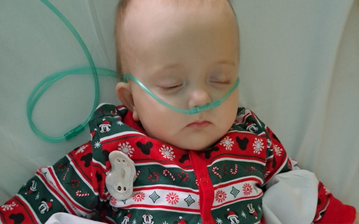 Zbiórka Operacja czopląsu - zdjęcie główne