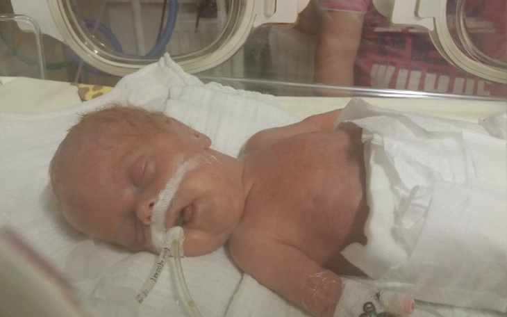 Zbiórka Rehabilitacja dla Nadii B. - zdjęcie główne