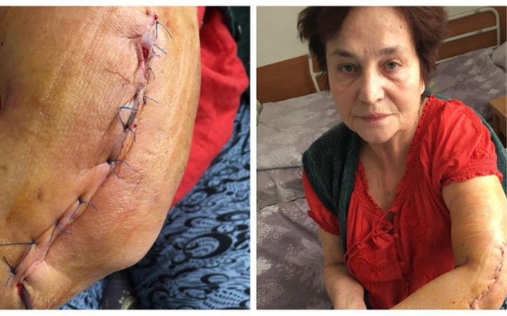 Zbiórka TATIANA-duże koszty operacji - zdjęcie główne