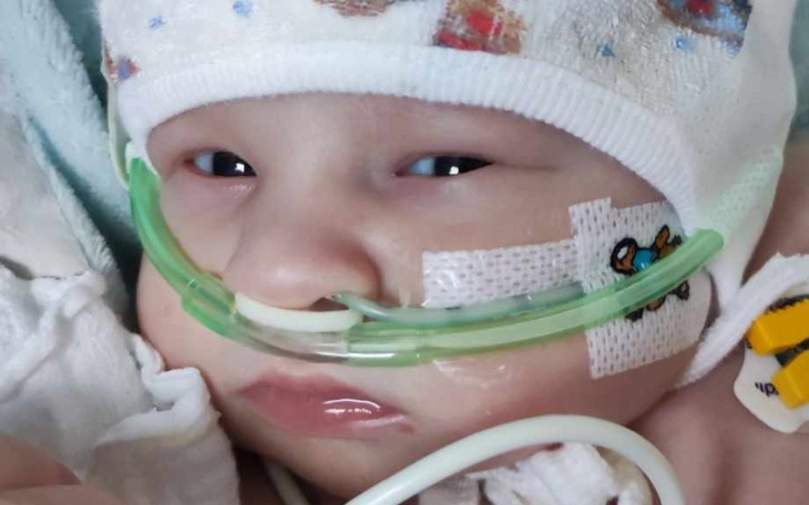 Noworodek z rurką tlenową w szpitalu.
