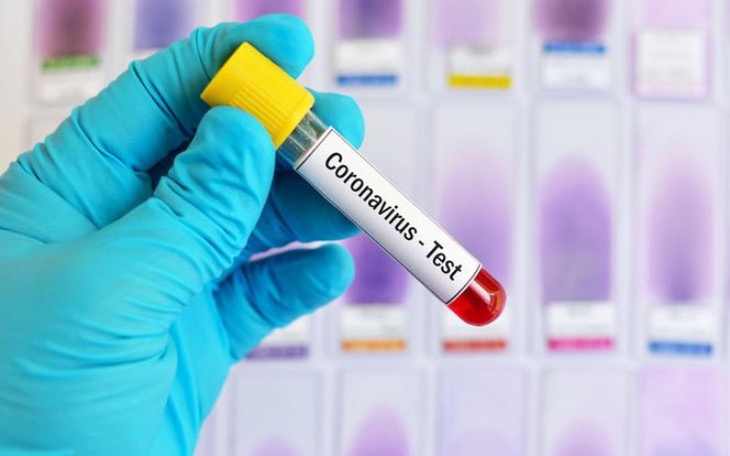 Zbiórka Testy KORONAWIRUS dla SZPITALI - zdjęcie główne