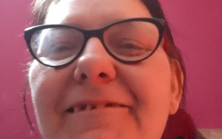 Zbiórka Zbieram na protezę zębową - zdjęcie główne