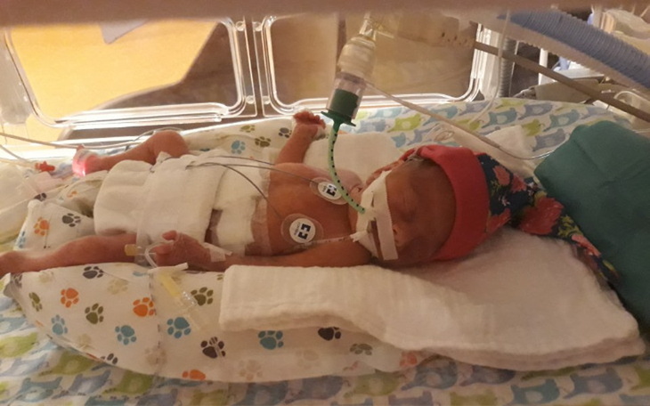 Zbiórka Dramatyczny start w życie Oliwki - zdjęcie główne