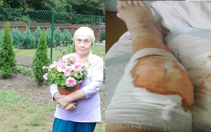 Zbiórka Na operacje dla starej kobiety - zdjęcie główne