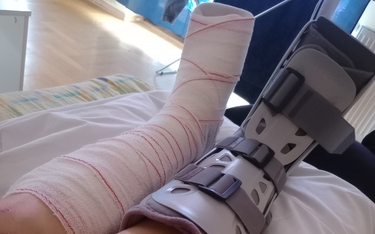 Zraniona noga w opatrunku, z unieruchomieniem.