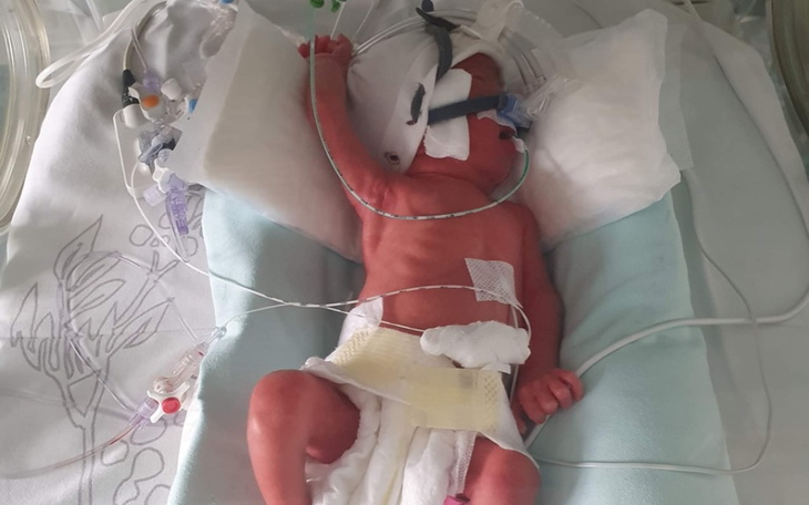 Zbiórka Rehabilitacja wcześniaka z 29 tc - zdjęcie główne