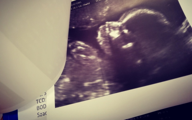 Zbiórka Pierogi z kaszanką - zdjęcie główne