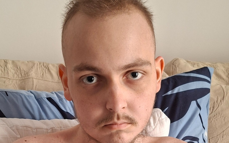 Młody mężczyzna z poważnym wyrazem twarzy.