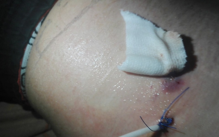 Zbiórka Marzenie bycia zdrowym - zdjęcie główne