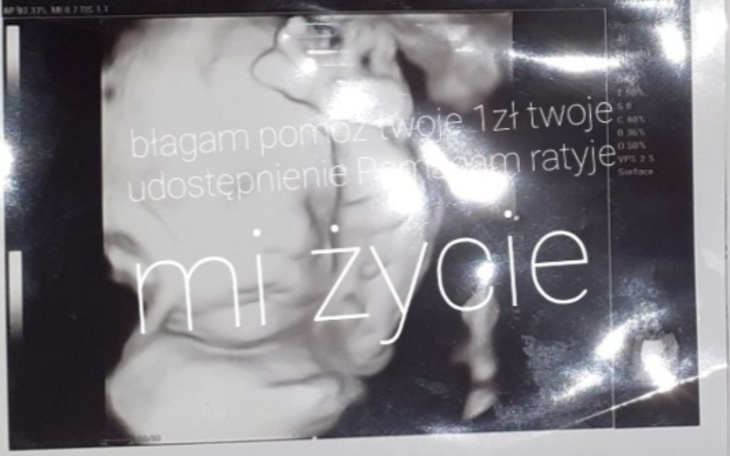 Zbiórka Uratuj serce Fabianka - zdjęcie główne