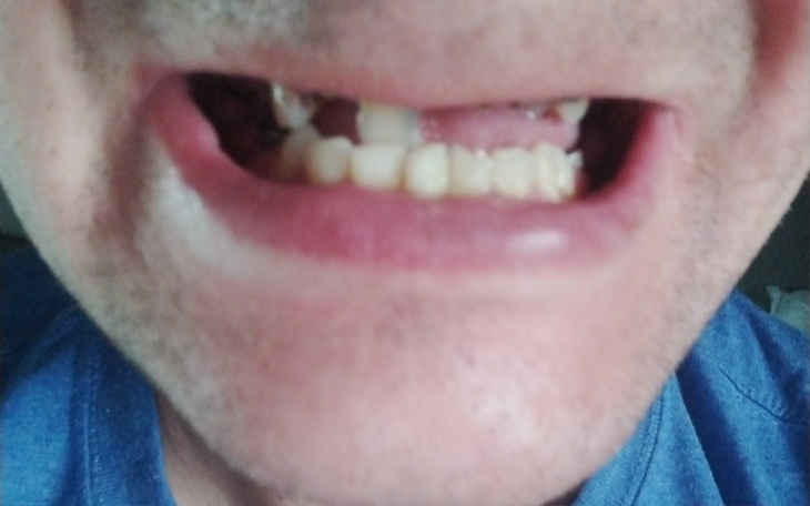 Zbiórka Na nowy uśmiech . - zdjęcie główne