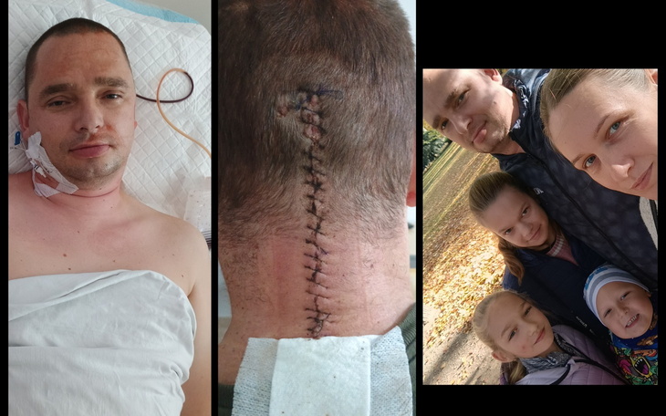 Mężczyzna w szpitalu z widoczną blizną na szyi.