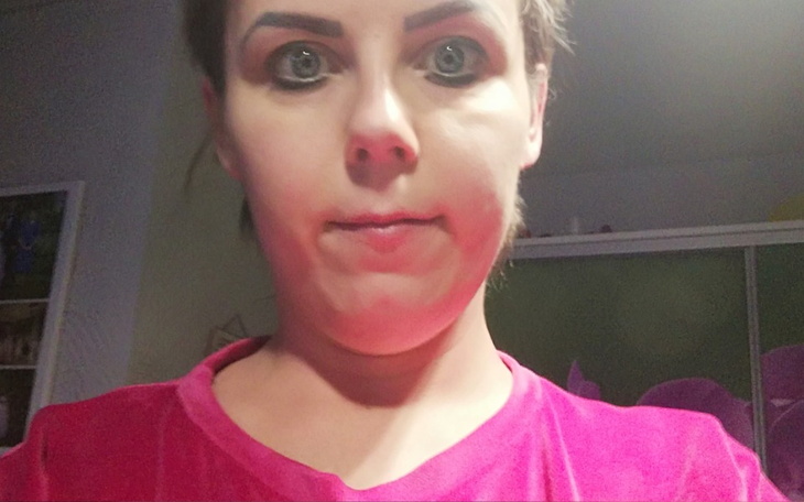 Zbiórka Nowotwór walka z nowotworem - zdjęcie główne