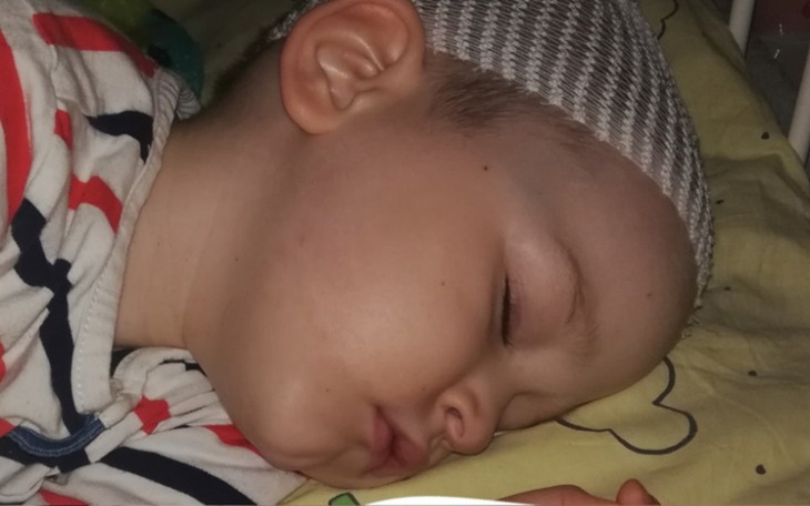 Zbiórka Pomóż Nam wygrać z glejakiem - zdjęcie główne