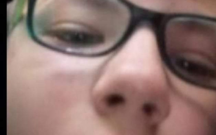 Zbiórka zbiórka na dziecko bez nogi - zdjęcie główne