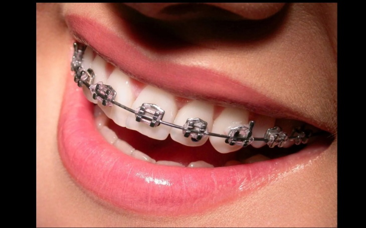 Zbiórka Zbiórka na zdrowe zęby - zdjęcie główne