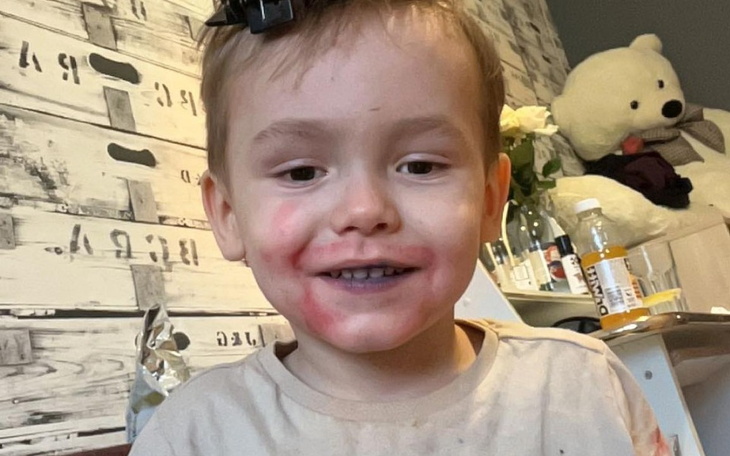 Zbiórka pilne leczenie Michałka - zdjęcie główne