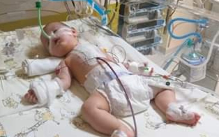 Zbiórka Julka potrzebuje waszej pomocy - zdjęcie główne