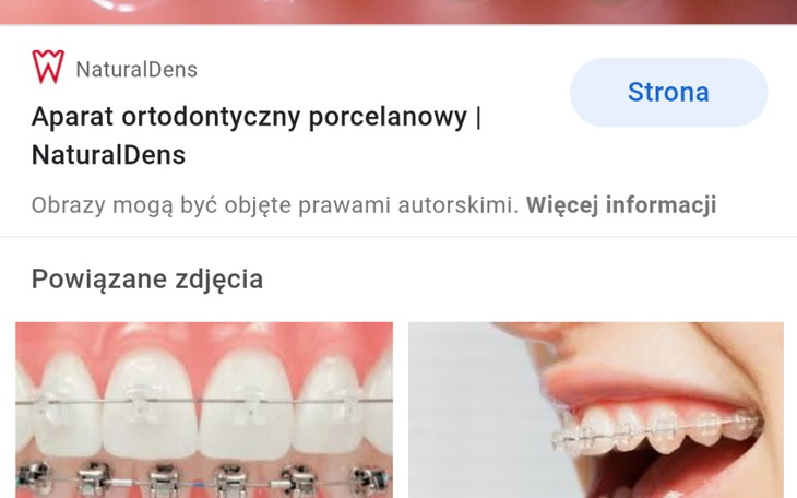 Zbiórka na ortodoncję - zdjęcie główne