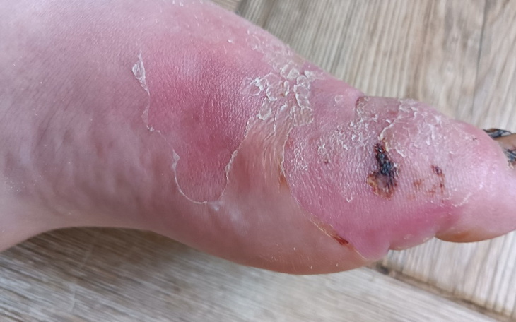 Zbiórka Zbieram Na Marzenia itp - zdjęcie główne