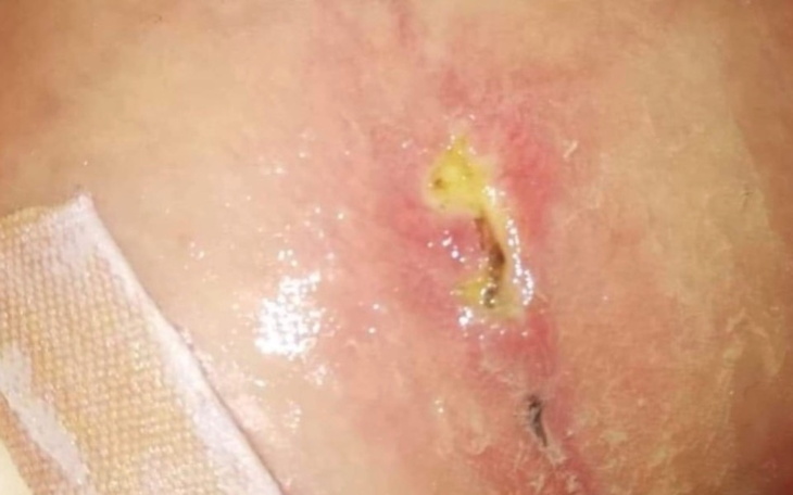 Zbiórka Chcę wrócić do normalność - zdjęcie główne