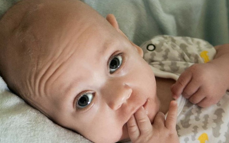 Zbiórka Wpłać grosika dla Alexika - zdjęcie główne