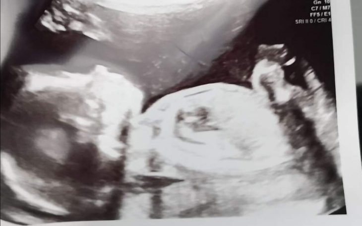 Zbiórka Pomoc dla Aniołkowych rodziców - zdjęcie główne