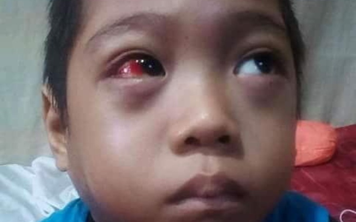 Zbiórka Chory na białaczkę, Adrian. - zdjęcie główne