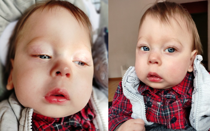 Zbiórka Leczenie Gabrysia - zdjęcie główne