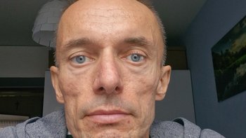 Zbiórka 29 stycznia moje życie się zatrzymało. Pomóż mi je odzyskać - miniaturka zdjęcia