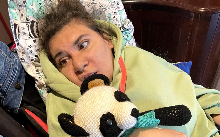 Zbiórka Leczenie i rehabitacja Oliwi - zdjęcie główne