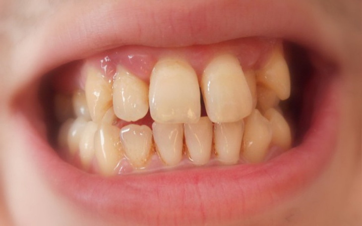 Zbiórka Na aparat ortodontyczny - zdjęcie główne