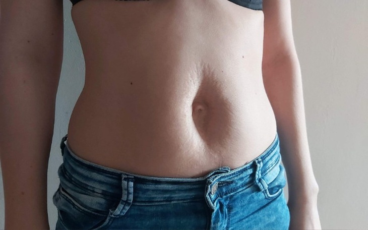 Zbiórka Zabieg zszycia mięśnia prostego - zdjęcie główne