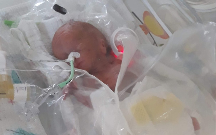 Zbiórka Michalina Cud 370.gram - zdjęcie główne