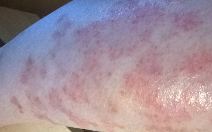 Zbiórka Kuracja nad Morzem Martwym - zdjęcie główne