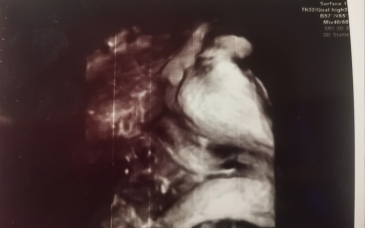 Zbiórka Młoda, samotna mama w ciąży - zdjęcie główne