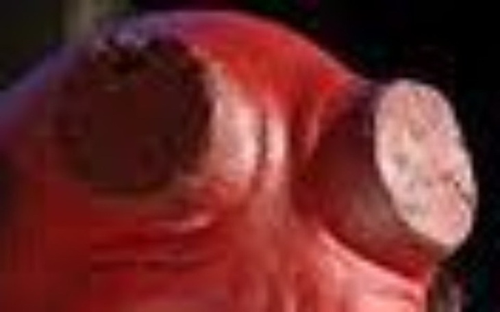 Zbiórka Ochraniacz na rogi dla Forka - zdjęcie główne