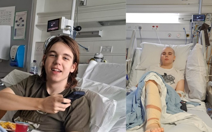 Dwóch chłopców w szpitalu, jeden z uśmiechem, drugi z opatrunkiem na nodze.