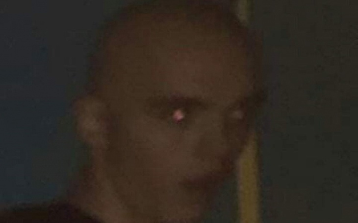 Zbiórka Przeszczep włosów dla melnika. - zdjęcie główne