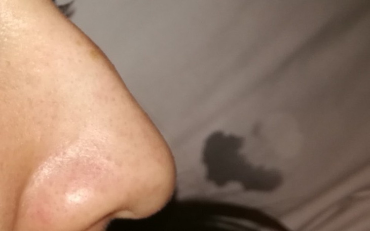 Zbiórka Na operację plastyczna...pomóż:) - zdjęcie główne