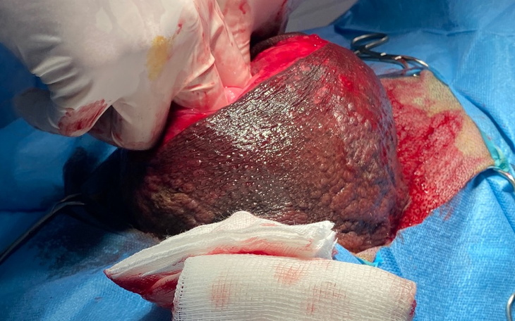 Zbiórka Balbinka z krwawiącym guzem - zdjęcie główne